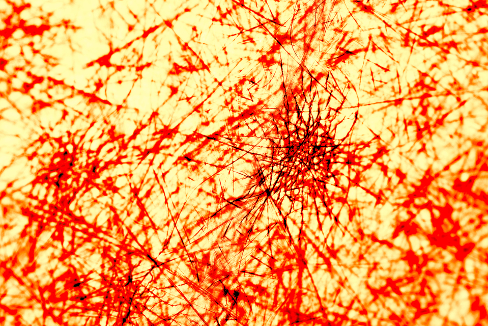 Blood Spider - ID 002681